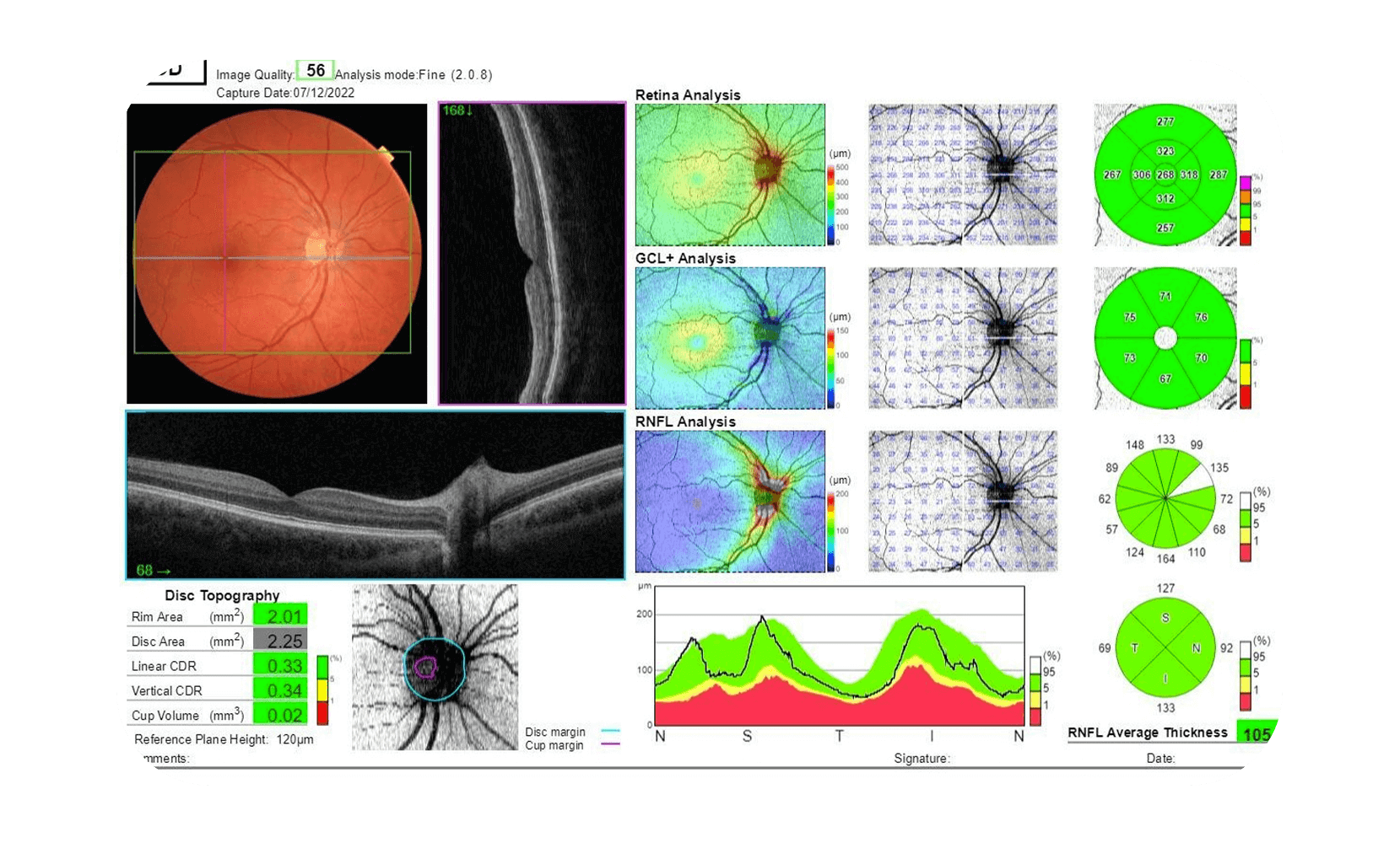 OCT Eye Exam | $39 Wellness Screening | 414 Eyes